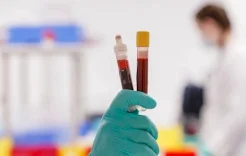 فحص جديد يكشف سرطان المثانة بدقة عالية