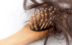 إليك حلول لتساقط الشعر إثر نقص الحديد 