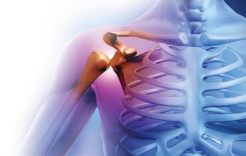 العلم يثبت فوائد نبتة برازيلية تقليدية لعلاج التهاب المفاصل