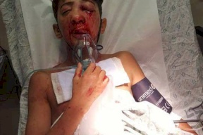 الاحتلال يصيب طفلا في العيسوية 