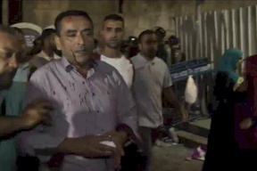 صور/ اصابات في اعتداء الاحتلال على مواطنين في القدس 