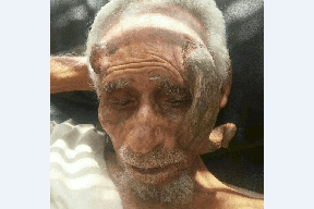 فيديو صادم….بهذه الطريقة المتوحشة تسببوا في قتل معمر باليمن بعد ظهور قرن في رأسه