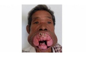صورة| لن تصدقوا كيف اصبح بعد عمليات التجميل!