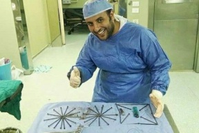 صور | لن تصدق ماذا وجد الاطباء في معدة مريض مصري!