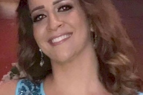 وفاة اردنية عقب عملية تجميل
