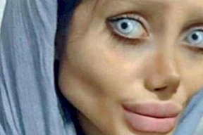 صور| سحر.. حاولت التشبه بانجلينا جولي وهذا ما حصل