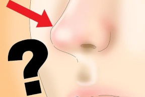 السؤال الاكثر حيرة..لماذا يسيل الأنف أثناء البرد؟