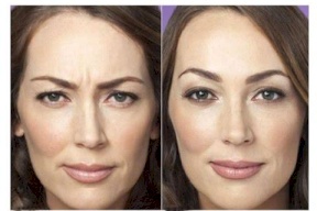 حيل سهلة لإخفاء الخطوط بين الحاجبين 