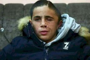 الاحتلال يحارب عائلة التميمي