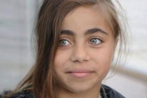 الصحة: جاهزون لزراعة كلية للطفة العطار