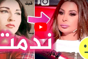 فيديو/ اليسا تندم من عمليات التجميل ! 