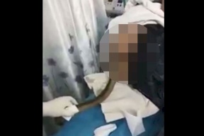 فيديو..لقطات صادمة لأطباء يزيلون ثعبان بحر من رجل