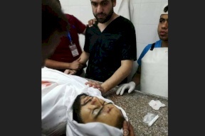 صورة القهر في غزة.. حينما يفاجأ الطبيب بجثة أخيه