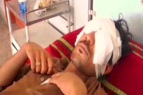 أراد الزواج على مزاجه فهاجمه أبوه وإخوته واقتلعوا عينيه