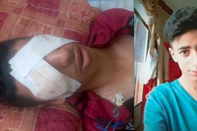 مناشدات لإنقاذه.. طلق نارى متفجر أفقد الطفل صالح أعز ما يملك