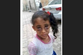 هذه الطفلة الجميلة عذبها والدها بوحشية!
