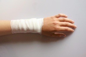 أخطاء شائعة في علاج حروق الأطفال