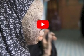 فتاة تتمنى ان تكون مثل البشر ! ما قصتها ؟ 