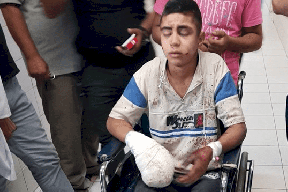 اصابة فتى بانفجار جسم مشبوه في الخليل