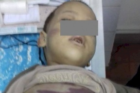 مصرية تعذب طفلها بعد أن شاهد شقيقته في أوضاع مخلة