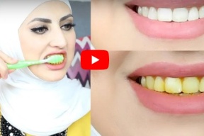 فيديو/ خلطة لتبييض الاسنان من أول استخدام