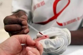 إصابة جديدة بالإيدز كل 3 دقائق لدى هذه الفئة!