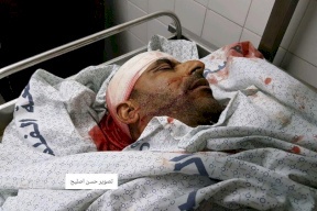 شهيد برصاص الاحتلال في غزة 