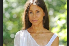 أحرقوا وجهها بالأسيد... هكذا كانت وهكذا أصبحت بعد 70 عملية تجميل