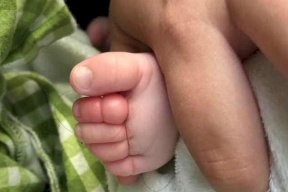 خصلة شعرها كادت أن تتسبب ببتر أصابع رضيعها
