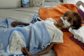 الأمم المتحدة تُحذر من مجاعة قد تطال 14 مليون شخص في اليمن