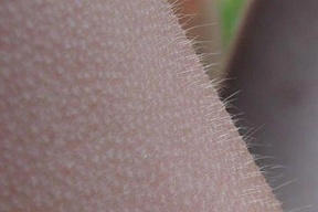 لماذا يشعر البشر بالقشعريرة؟