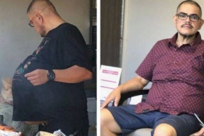 استأصلوا من بطنه ورماً بوزن 35 كيلو!