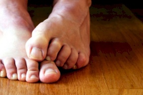 خطوات لعلاج فطريات القدم