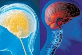 هذا هو الفارق بين أدمغة النساء والرجال