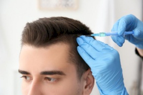 خطوات عملية زراعة الشعر والتعليمات الواجب اتباعها