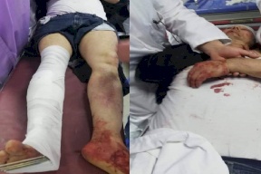 صور.. يعاني جروحاً خطيرة.. هكذا اعتدت حماس على عاطف ابو سيف