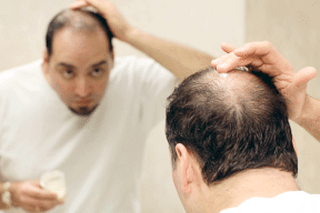 الحل الأمثل لعلاج تساقط الشعر