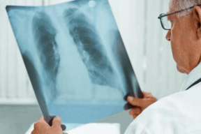 طريقة لا تخطر في البال لعلاج التهابات الرئة