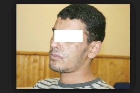 قال إنه أعمى.. وهذا ما حدث!