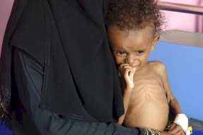 50 مليون شخص في المنطقة يعانون من "نقص التغذية"