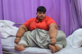 طبيب يتعهد بعلاج الطفل الأكثر بدانة في العالم بعد محاولات بائسة عديدة