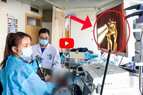 فيديو.. فتاة تبتلع ذهبها لهذا السبب ! 