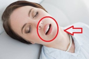 لماذا ينام البعض وافواههم مفتوحة؟