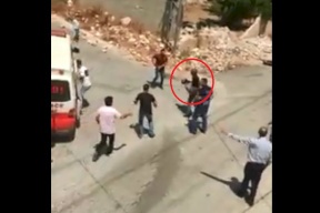 بالفيديو.. لحظة اصابة طفل برصاص الاحتلال في قلقيلية