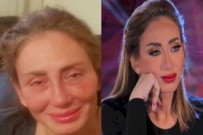 مرض ريهام سعيد:  تمت إزالة أنفها بالكامل!