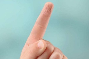 لماذا يتغيّر شكل جلدك عند الاستحمام؟