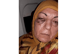 صورة السيدة العراقية المضروبة في إيران تثير غضب العراقيين