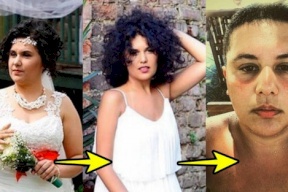 ممثلة تركية تخضع لعملية تحويل جنس