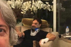 فقد الذاكرة مؤقتاً.. صوراً مروعة لعاصي الحلاني بعد نجاته من الموت بمُعجزة