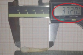 طبيب اسنان يدخل "غينيس" بعد خلع أطول سن
